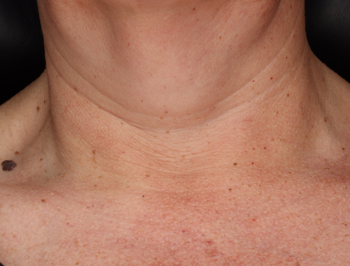 Neck Complex Anti-Aging + Brightening Serum